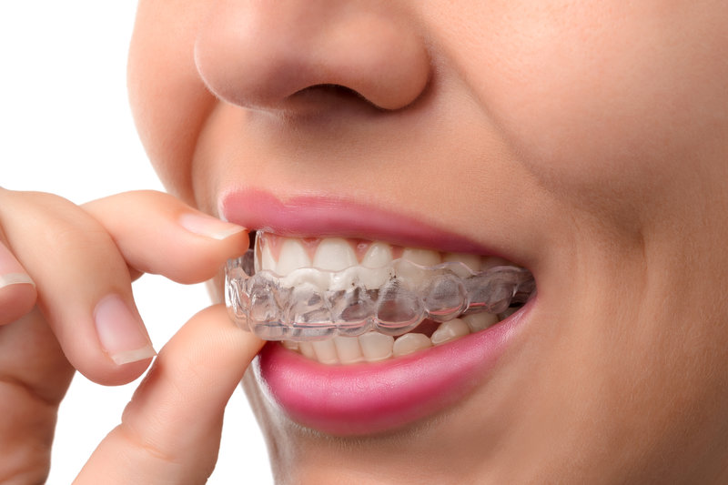 Orthodontics (Braces & Aligners)
